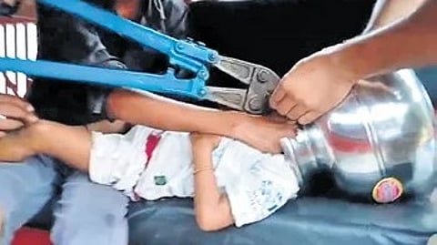 खेळता खेळता चिमुकल्याचं डोकं अडकलं&hellip;