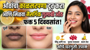 ओठांचा काळसरपणा दूर करा आणि मिळवा नैसर्गिक गुलाबी&hellip;